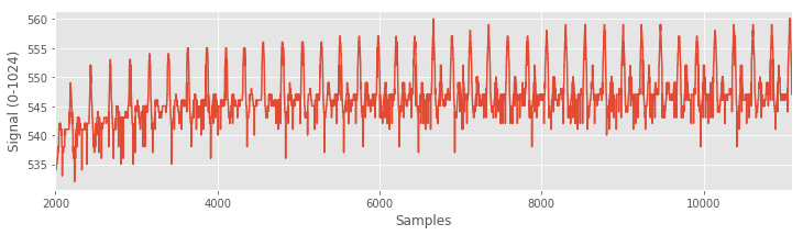 Pulse sensor data, zoomed on a subset of the data